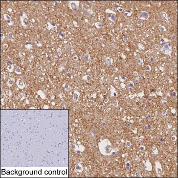 Mouse Monoclonal Antibody to DBN1