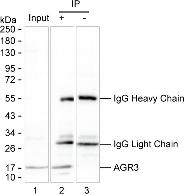 AGR3