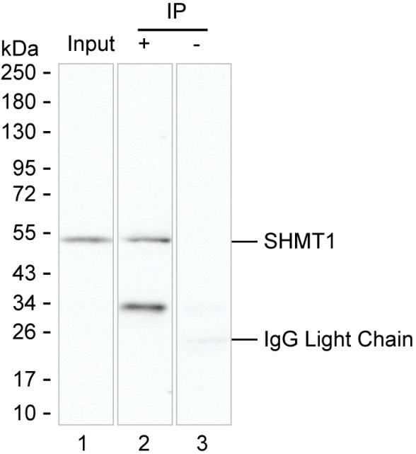 SHMT1