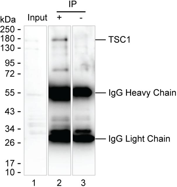 Mouse Monoclonal Antibody to TSC1