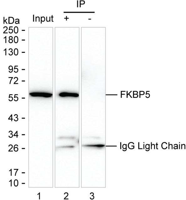 FKBP5