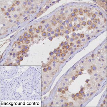CBLL2