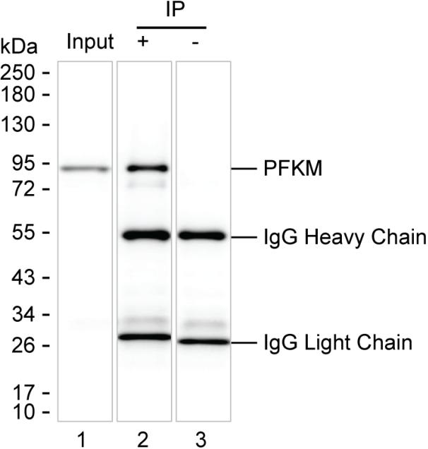 PFKM