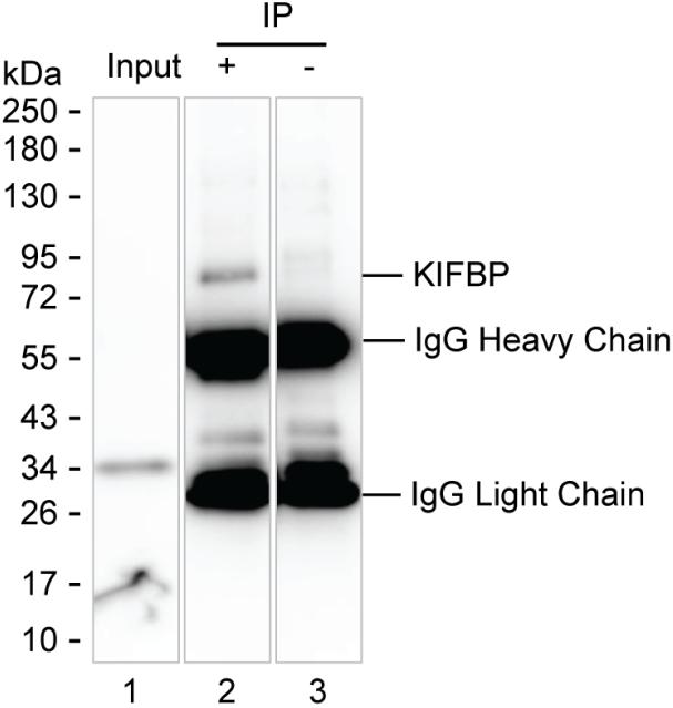 KIFBP