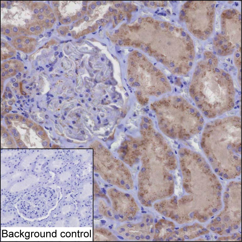 Mouse Monoclonal Antibody to KIFBP