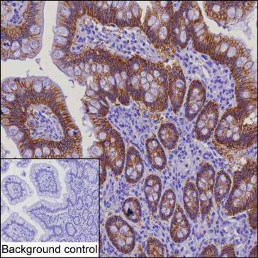 Mouse Monoclonal Antibody to CLDN3