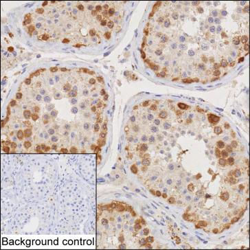 CTAG1A