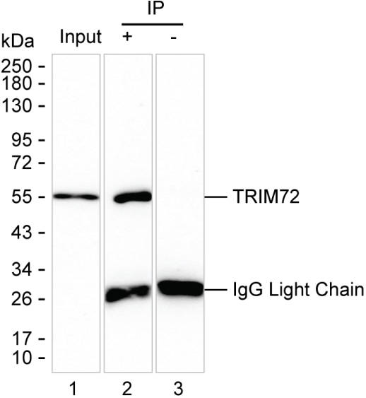 TRIM72