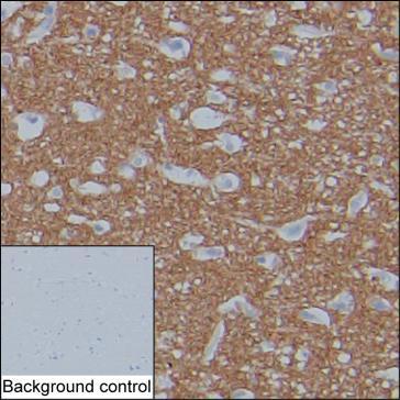 Mouse Monoclonal Antibody to Tau