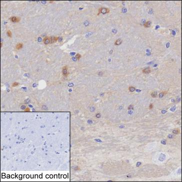 Rat Monoclonal Antibody to Mapre2