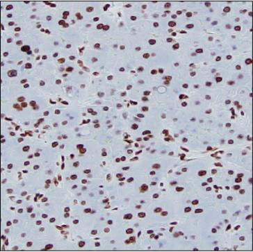 Rat Monoclonal Antibody to Histone H3K9ac