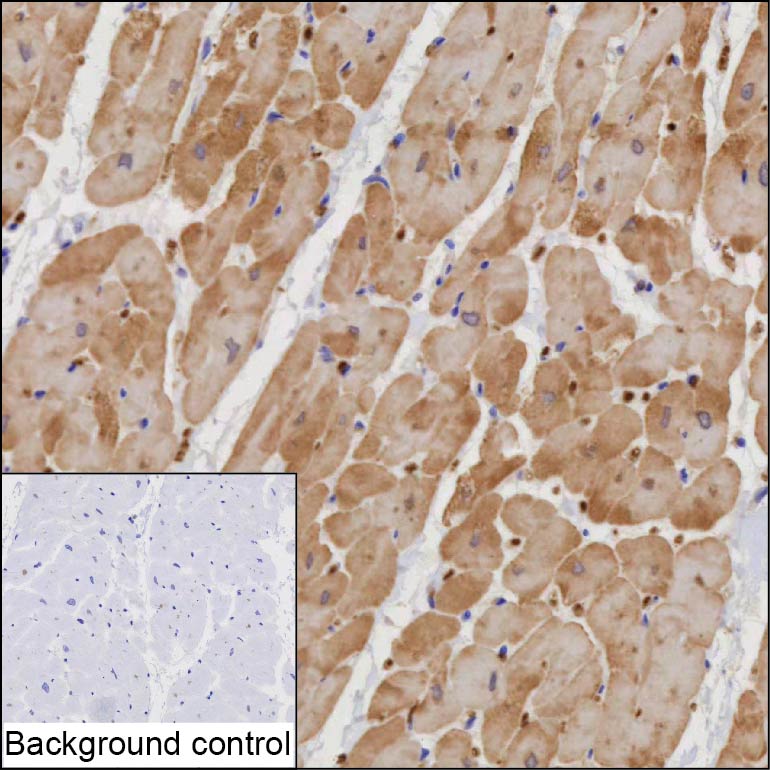 ITGB1BP1