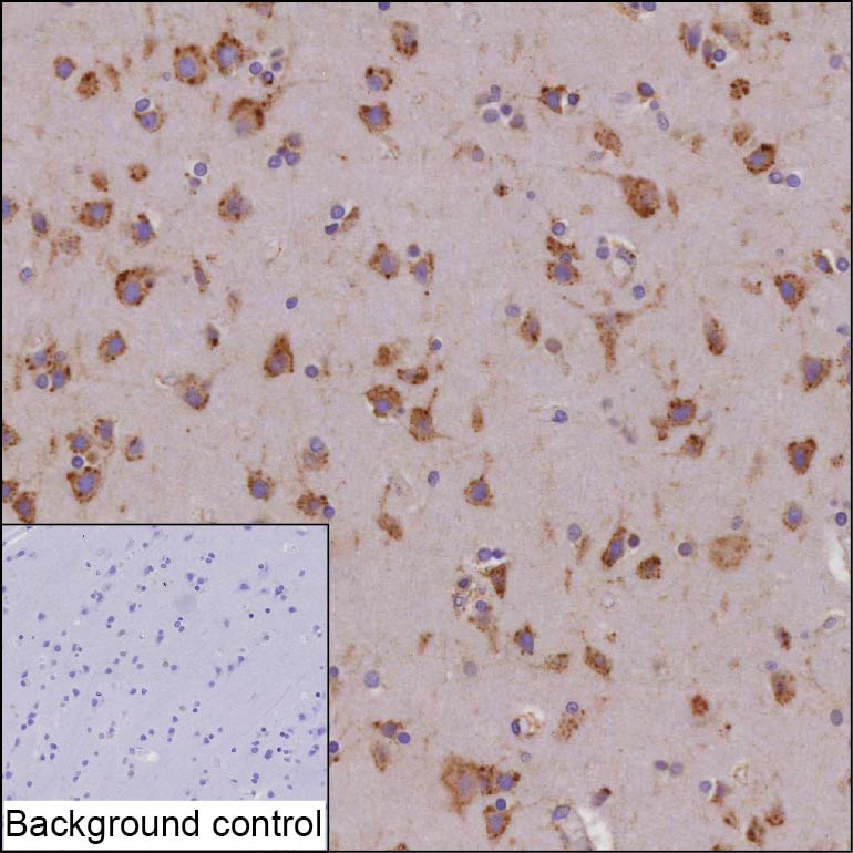 CDC42BPB