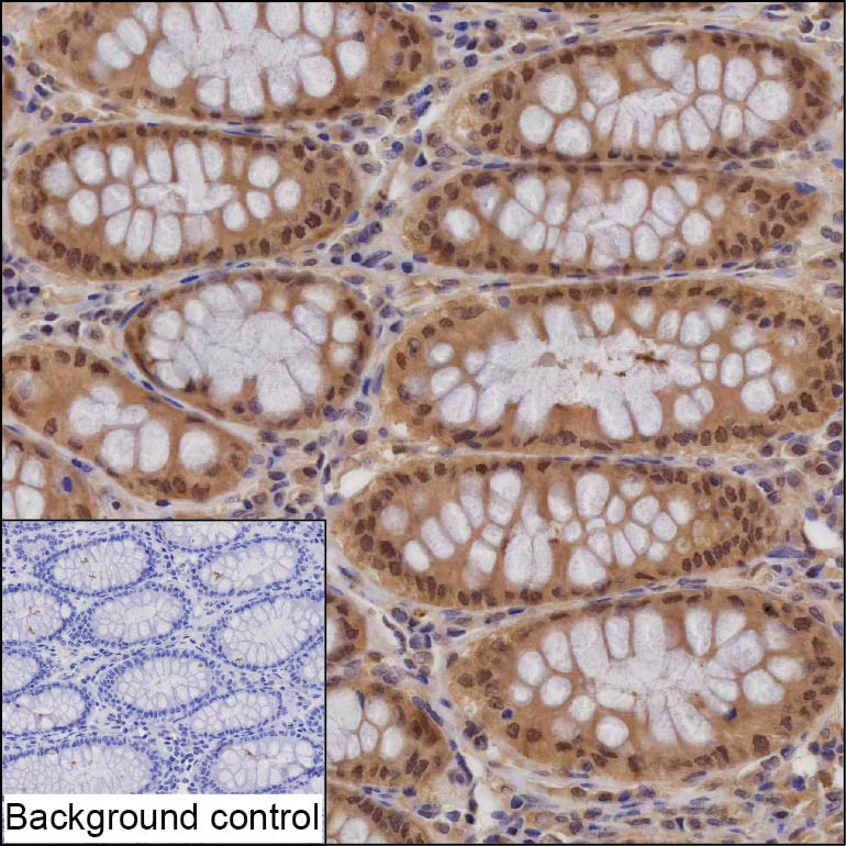 PSMA1