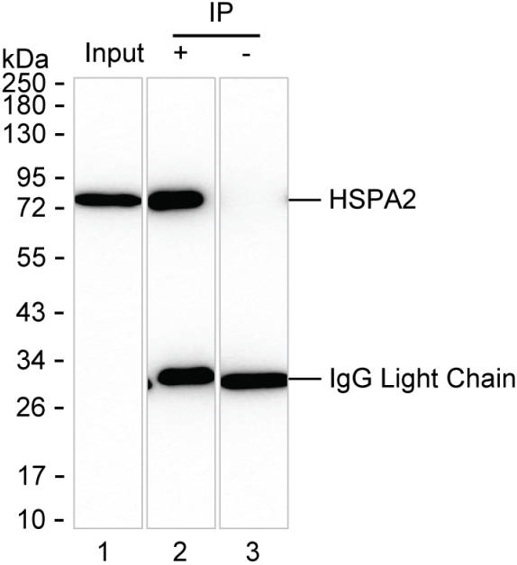 HSPA2