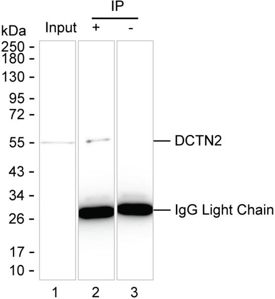 DCTN2