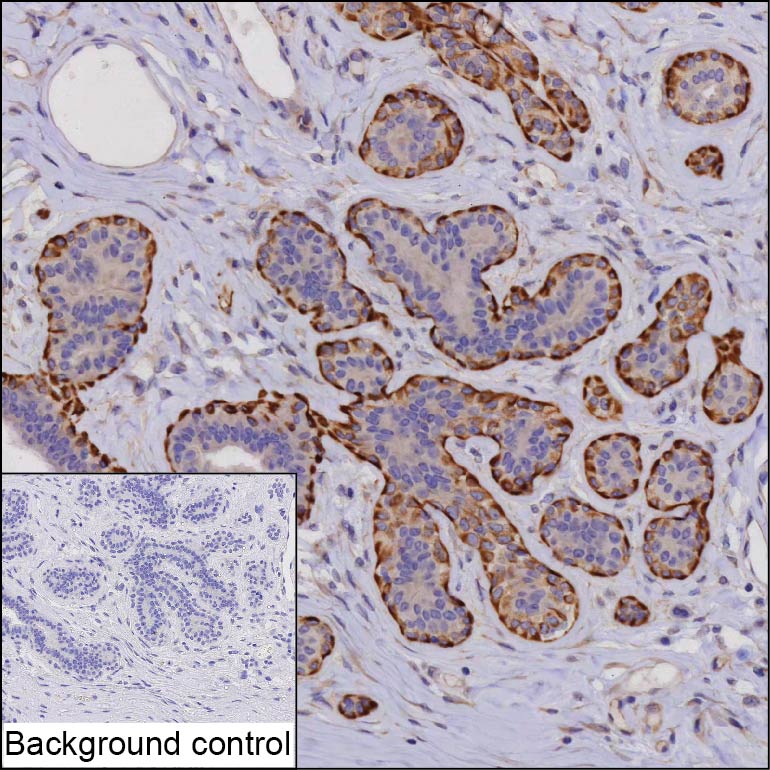 MMP13