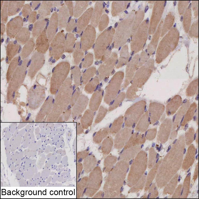 CDH15