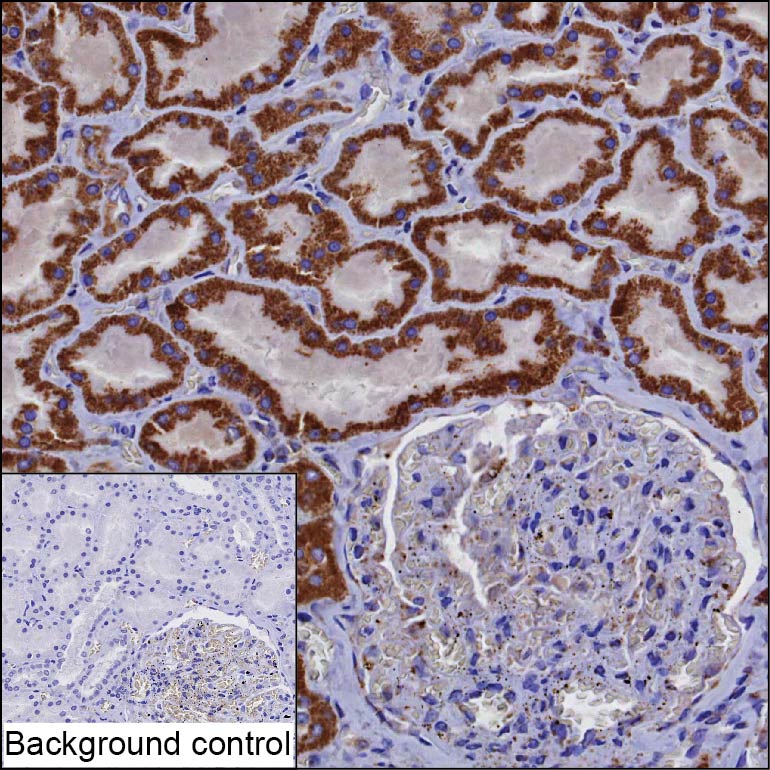 ATP6AP2