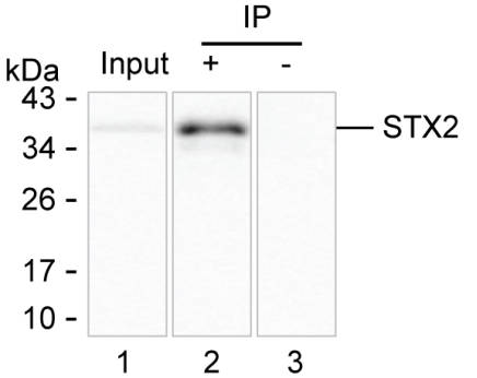 STX2