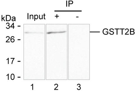 GSTT2B