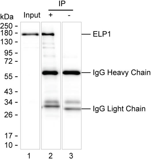 ELP1