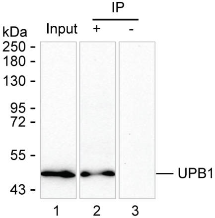 UPB1
