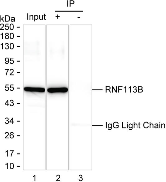 RNF113B