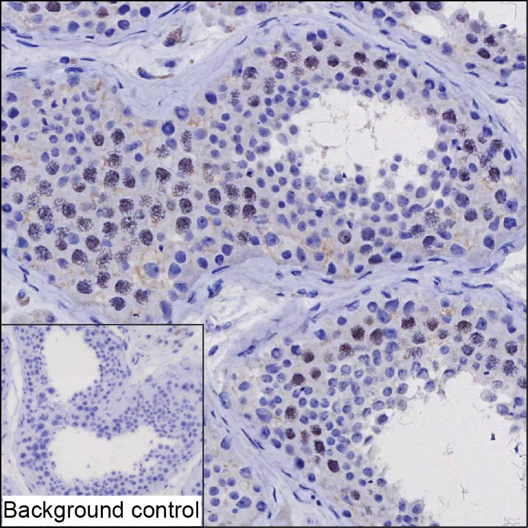 ZNF174