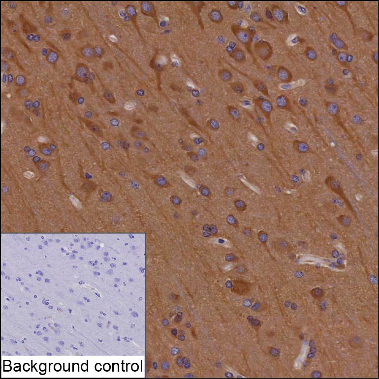 RNF19A