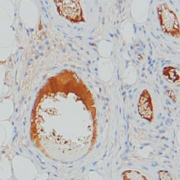 Mouse Monoclonal Antibody to SERPING1