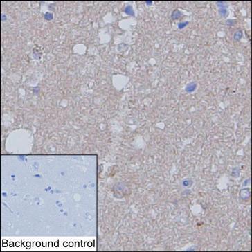 Mouse Monoclonal Antibody to ANK2