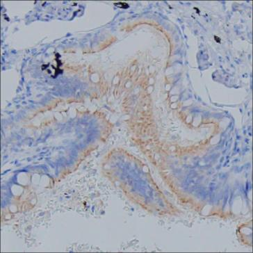 Rat Monoclonal Antibody to MAPRE3