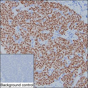 Rat Monoclonal Antibody to Gata3