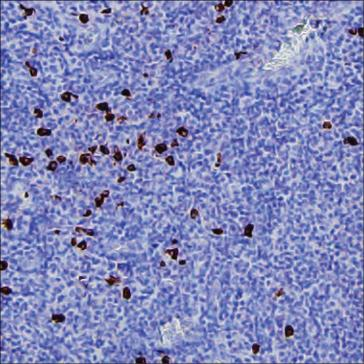 Mouse Monoclonal Antibody to Human IgG4