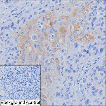 Mouse Monoclonal Antibody to INHBA