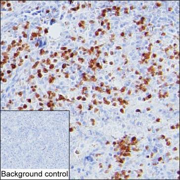 Mouse Monoclonal Antibody to S100A12