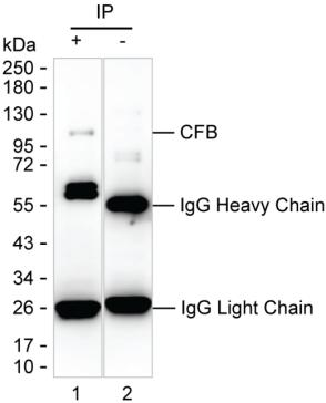 Mouse Monoclonal Antibody to CFB