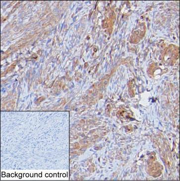Mouse Monoclonal Antibody to LMOD1