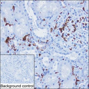 Mouse Monoclonal Antibody to SLC4A1