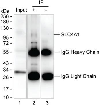 SLC4A1