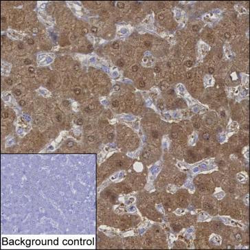 Mouse Monoclonal Antibody to KHK