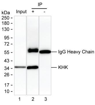 KHK
