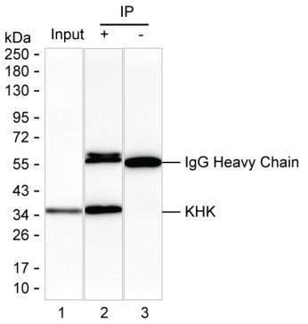 Mouse Monoclonal Antibody to KHK