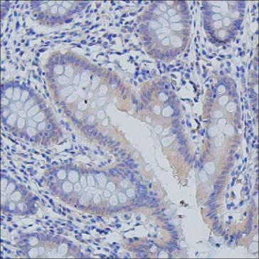Mouse Monoclonal Antibody to PDE5A