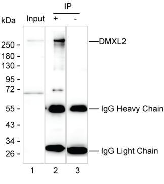 Mouse Monoclonal Antibody to DMXL2