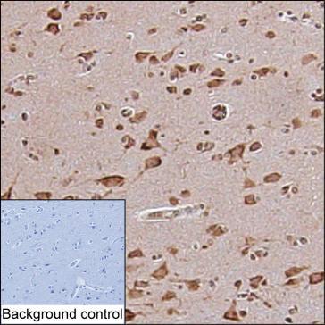 Mouse Monoclonal Antibody to DMXL2