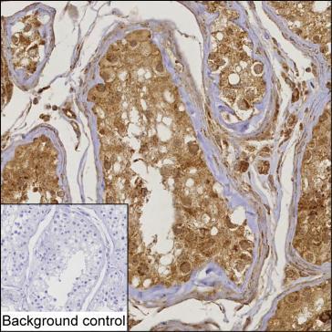 Mouse Monoclonal Antibody to TSNAX