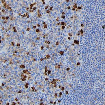 Mouse Monoclonal Antibody to JCHAIN