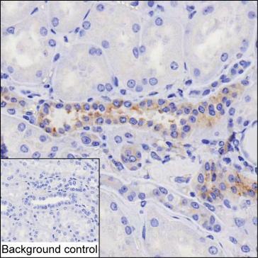 Mouse Monoclonal Antibody to HIP1